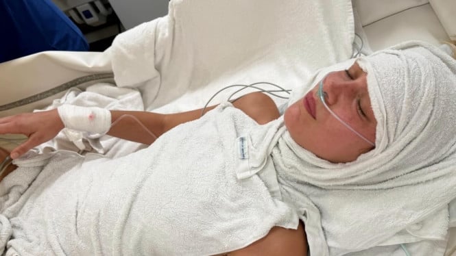 Bella Hadid Jalani Perawatan Intensif, Lawan Penyakit Lyme