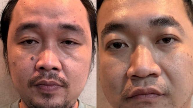 Polisi Bongkar Jaringan Narkoba Ko Erwin, Buru ‘The Doctor’!