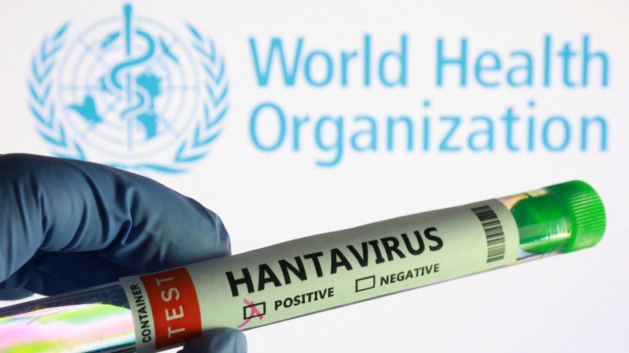 Dinkes Kulon Progo Pastikan Suspek Hantavirus Negatif