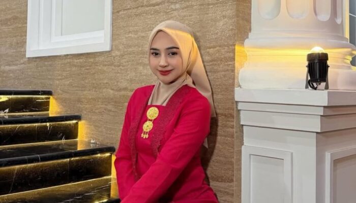 Ria Ricis Buka Suara Soal Operasi Plastik dan Isu Tindik Hidung